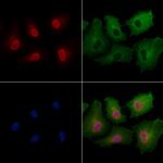 DDB2 Polyclonal Antibody