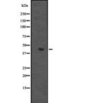 DDB2 Antibody in Western Blot (WB)