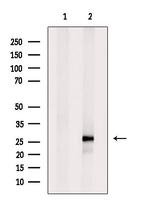 DIRAS3 Antibody in Western Blot (WB)