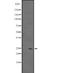 DUSP26 Polyclonal Antibody