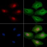 EHMT1 Polyclonal Antibody