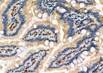 FN3K Polyclonal Antibody