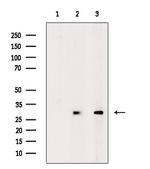 GPR146 Polyclonal Antibody