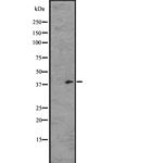 GPR21 Polyclonal Antibody