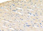 GPR81 Antibody in Immunohistochemistry (Paraffin) (IHC (P))