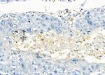 GPR81 Antibody in Immunohistochemistry (Paraffin) (IHC (P))