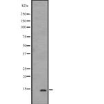 IFITM1 Polyclonal Antibody
