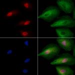 ING2 Polyclonal Antibody