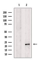 ITGB1BP1 Polyclonal Antibody