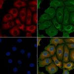 Cytokeratin 1 Polyclonal Antibody