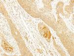 Cytokeratin 1 Antibody in Immunohistochemistry (Paraffin) (IHC (P))