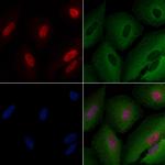 MSH3 Polyclonal Antibody