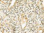 NFE2L1 Polyclonal Antibody