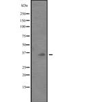 CD273 (B7-DC) Polyclonal Antibody