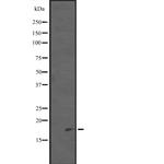 PDCD5 Polyclonal Antibody