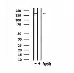 PIK3C2A Polyclonal Antibody