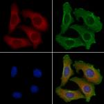 PKC eta Polyclonal Antibody