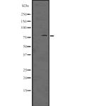 PKC eta Antibody in Western Blot (WB)
