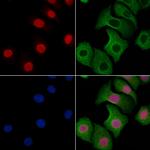 ESRP2 Polyclonal Antibody