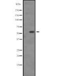 SGK3 Polyclonal Antibody
