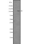 SRRM1 Antibody in Western Blot (WB)