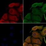 TAB2 Polyclonal Antibody