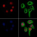 UBC3B Polyclonal Antibody