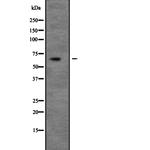 UNC5C Polyclonal Antibody