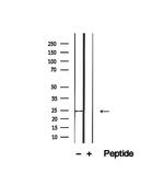 CD28 Antibody in Western Blot (WB)