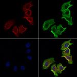 NCEH1 Polyclonal Antibody