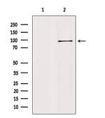 AAK1 Polyclonal Antibody
