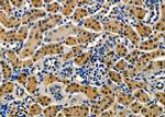 ABCB10 Polyclonal Antibody