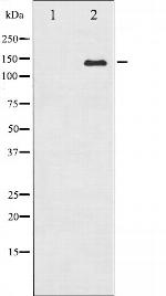 ABL1/ABL2 Polyclonal Antibody