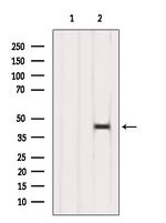 ACAA1 Polyclonal Antibody