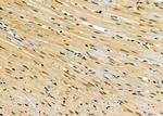 ACBD7 Antibody in Immunohistochemistry (Paraffin) (IHC (P))