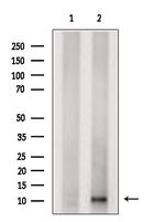 ACBD7 Antibody in Western Blot (WB)