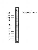 Acetylated Lysine Polyclonal Antibody
