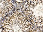 ACOX2 Antibody in Immunohistochemistry (Paraffin) (IHC (P))