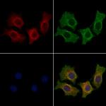 ACVR1 Polyclonal Antibody