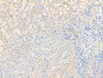ACVR1 Antibody in Immunohistochemistry (Paraffin) (IHC (P))