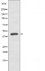 BAF53A Polyclonal Antibody