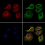 ACTR1A Polyclonal Antibody