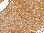 ACTR1A Antibody in Immunohistochemistry (Paraffin) (IHC (P))