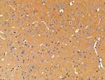 ACTR1A Antibody in Immunohistochemistry (Paraffin) (IHC (P))