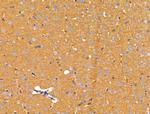 ACTR1A Antibody in Immunohistochemistry (Paraffin) (IHC (P))