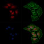 ADCY10 Polyclonal Antibody