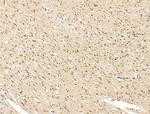 ADCY10 Antibody in Immunohistochemistry (Paraffin) (IHC (P))