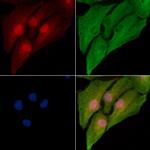 alpha-1b Adrenergic Receptor Polyclonal Antibody