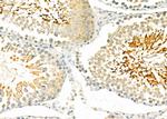 Apelin receptor Antibody in Immunohistochemistry (Paraffin) (IHC (P))