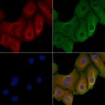 AHA1 Polyclonal Antibody